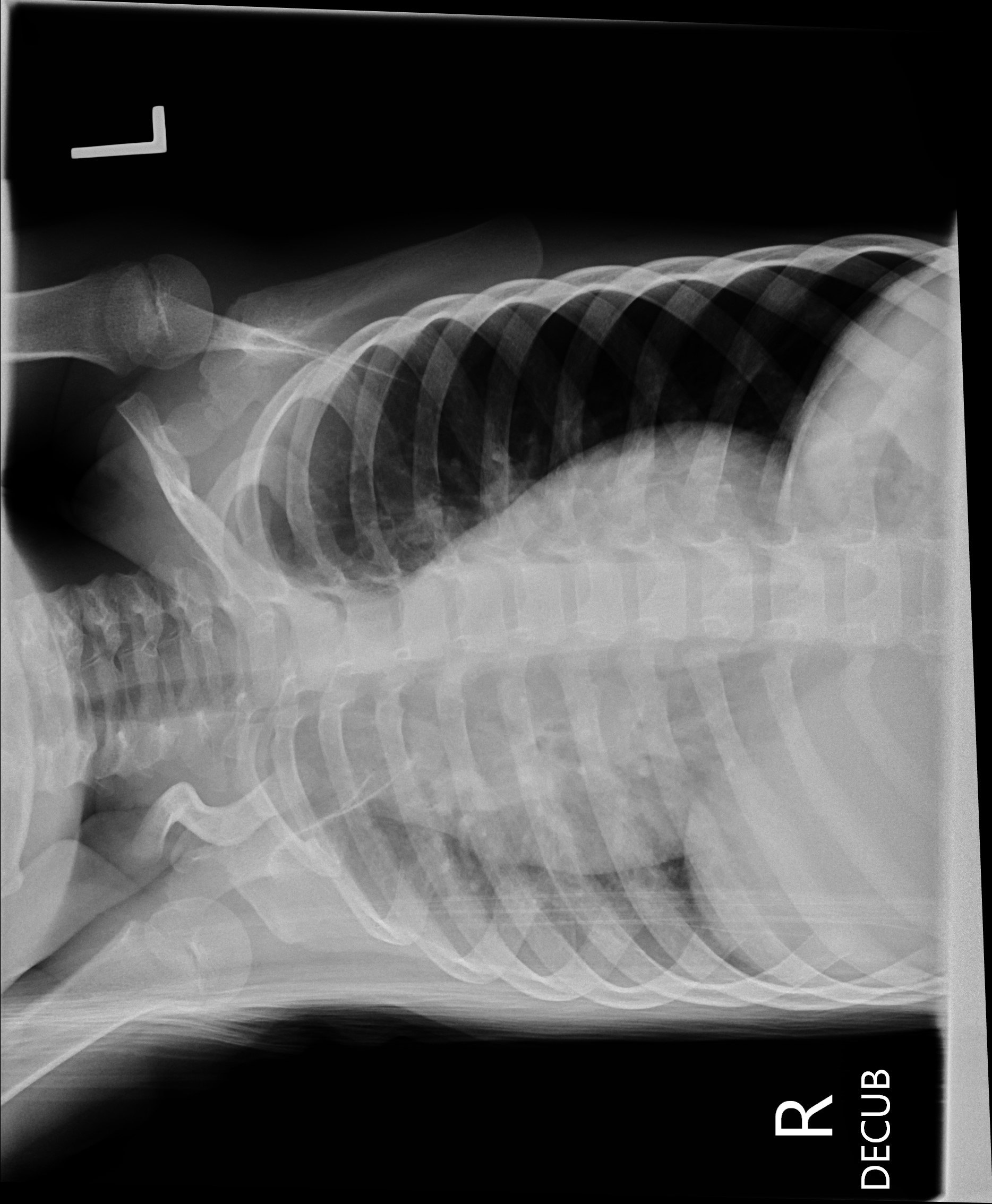 surgical-positioning-lateral-decubitus-trialexhibits-inc